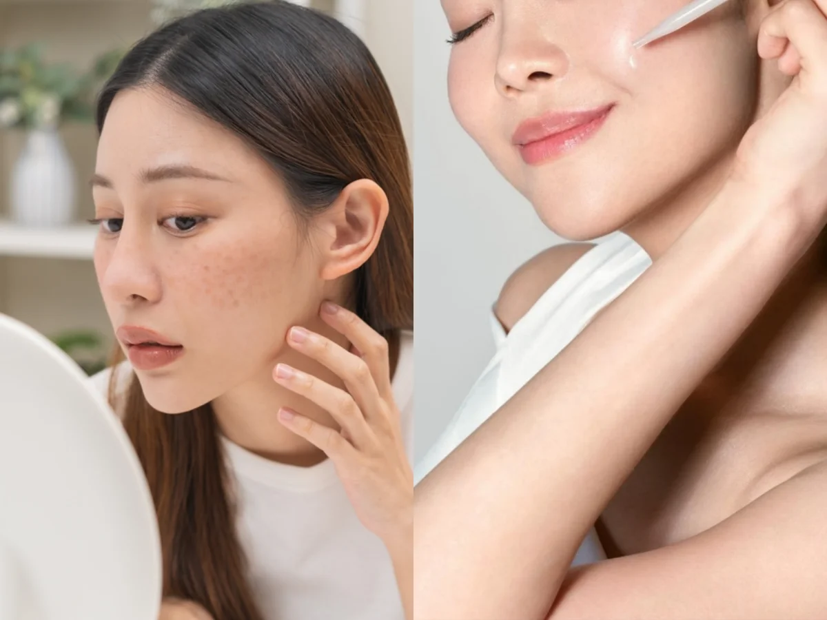 醫美後頭皮保養差一步全白做！髮量、蓬鬆感一起掉？專家點名少了這件事效果直接打折