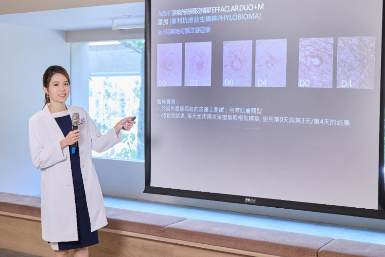 痘痘長不停？皮膚科醫師高珮菡授抗痘保養4重點！擠完粉刺痘痘不想留疤，先做「這件事」是關鍵