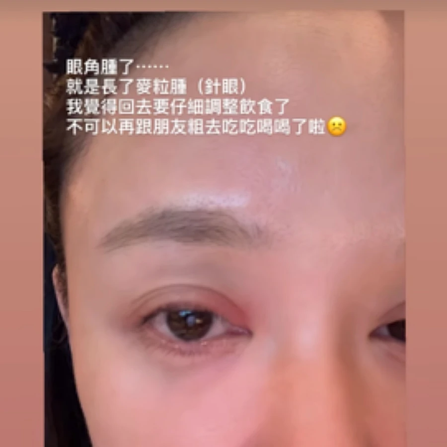 陳喬恩素顏照曝光!自曝臉上長了怪物 陳喬恩素顏照曝光!自曝臉上長了怪物