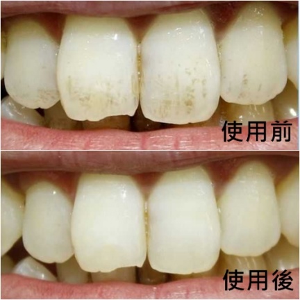 美白牙齒有秘訣，靠「這些」讓你從滿口黃牙變白帥帥！