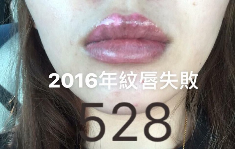 愛美女孩看過來！紋唇請慎選美容師！不然一醜就是好幾年...