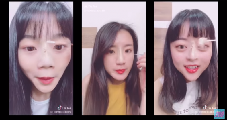 5. - 5..png 無痛整鼻?!原來抖音網美的高挺鼻都是這麼來的!