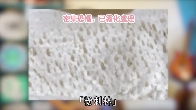 妳超愛拔粉刺的爽感？別傻了！其實妳拔的根本不是粉刺...