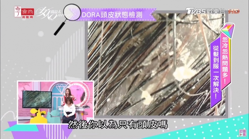 換季頭皮癢？頭皮屑好嚴重？鑽石小藍瓶的3大「植覺」密技快筆記！