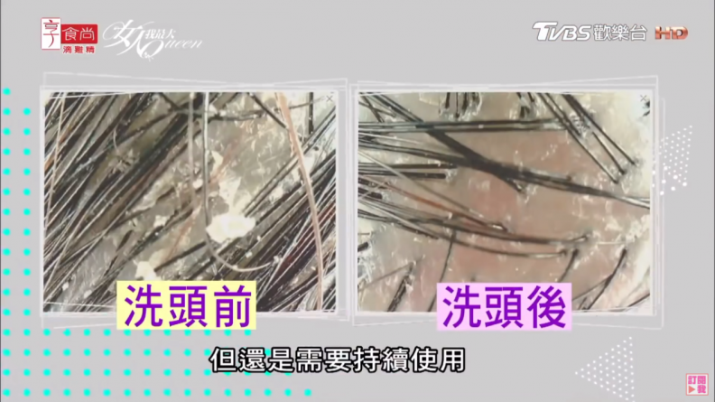 換季頭皮癢？頭皮屑好嚴重？鑽石小藍瓶的3大「植覺」密技快筆記！