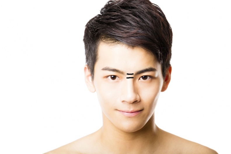 ▲山根出現橫紋