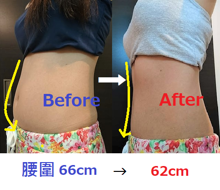瘦腰 - 瘦腰.png 一天只要10分鐘!呼拉圈瘦身法一個月腰瘦練出腹肌!