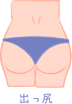 150706 hip dechiri - 150706_hip_dechiri.png 「4招讓妳找回緊緻翹臀」管妳是屁屁外擴還是下垂型這4種NG屁屁都能救!