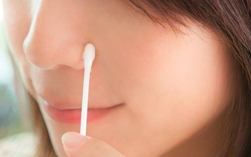 淡化唇紋、消黑眼圈，巷仔內才懂的凡士林24種用法