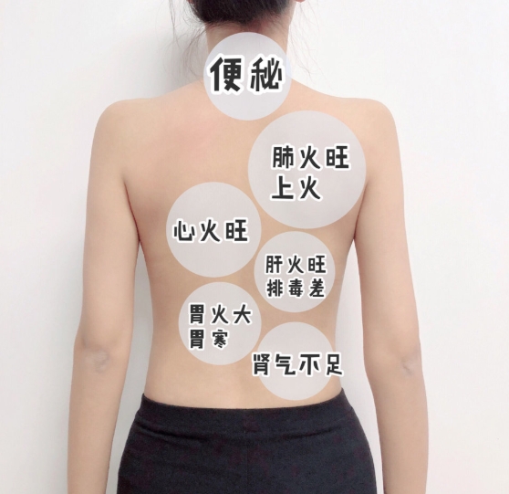 長背痘區域＝身體狀況指標！「5招」去背痘、消痘印超有感