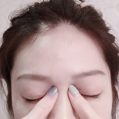 我沒哭，只是眼睛腫！每天3招輕鬆告別腫泡無神眼
