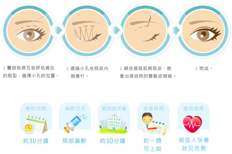 好想有雙眼皮喔！割還是縫呢？醫生說：搞懂這些事才能有迷人電眼