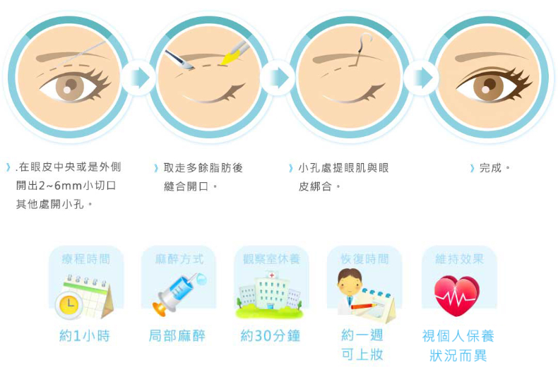 好想有雙眼皮喔！割還是縫呢？醫生說：搞懂這些事才能有迷人電眼