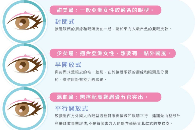 好想有雙眼皮喔！割還是縫呢？醫生說：搞懂這些事才能有迷人電眼