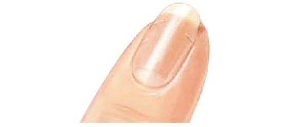 30秒自我檢測！從「指甲」看健康狀態，直條紋＝老化？！