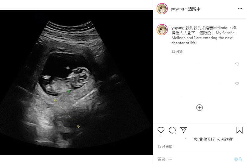 快訊／楊祐寧爆「密婚生子」！IG曬娃，證實：我要進入人生下一個階段！