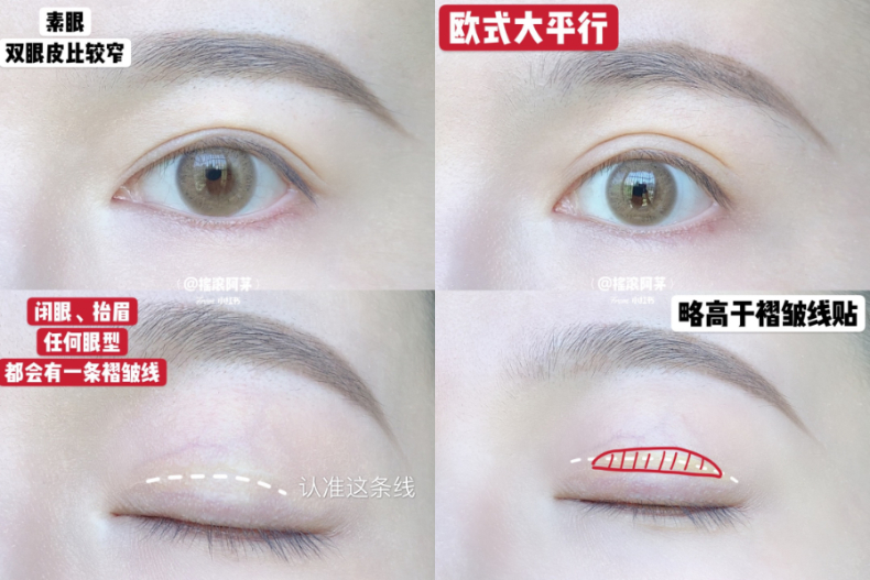 擁有深邃雙眼皮不是夢！3種貼法、眼皮貼推薦，拯救內雙、腫泡眼