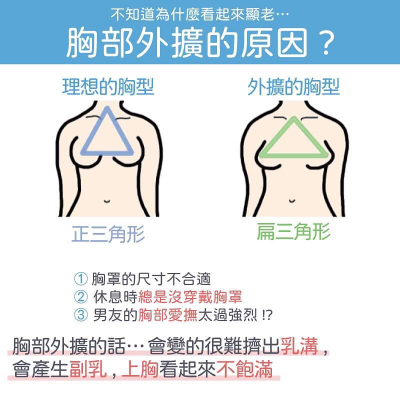ㄋㄟㄋㄟ下垂兼外擴，讓你看起來像老奶奶！「胸部外擴」判斷標準快看懂