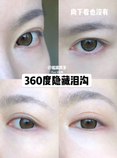 FotoJet (7) - FotoJet (7).jpg 黑眼圈、淚溝讓你老10歲!3步驟隱形術快學起來,效果竟比修圖還神奇