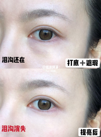 FotoJet (8) - FotoJet (8).jpg 黑眼圈、淚溝讓你老10歲!3步驟隱形術快學起來,效果竟比修圖還神奇