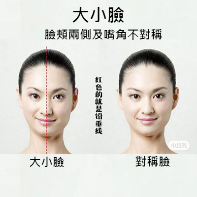 咬住！零技巧筷子瘦臉操，每天10分鐘矯正不對稱大小臉