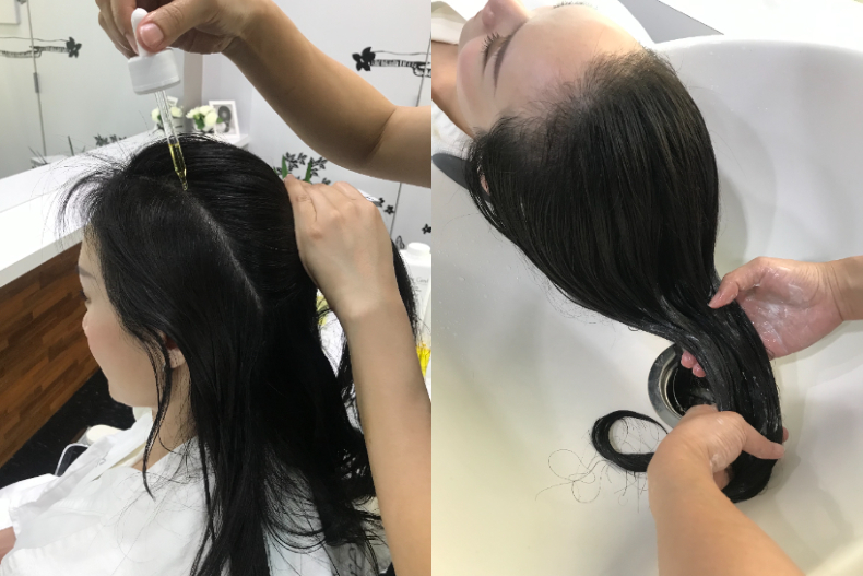 FotoJet (1) - FotoJet (1).jpg 髮際線倒退嚕?3原因導致你加速掉髮!正常掉髮量超過「這數字」就要小心
