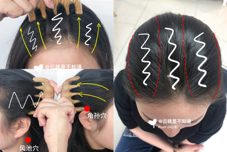 每天５分鐘，「頭皮刮痧」找回濃密髮！強化髮根、促進血液循環，還能預防偏頭痛