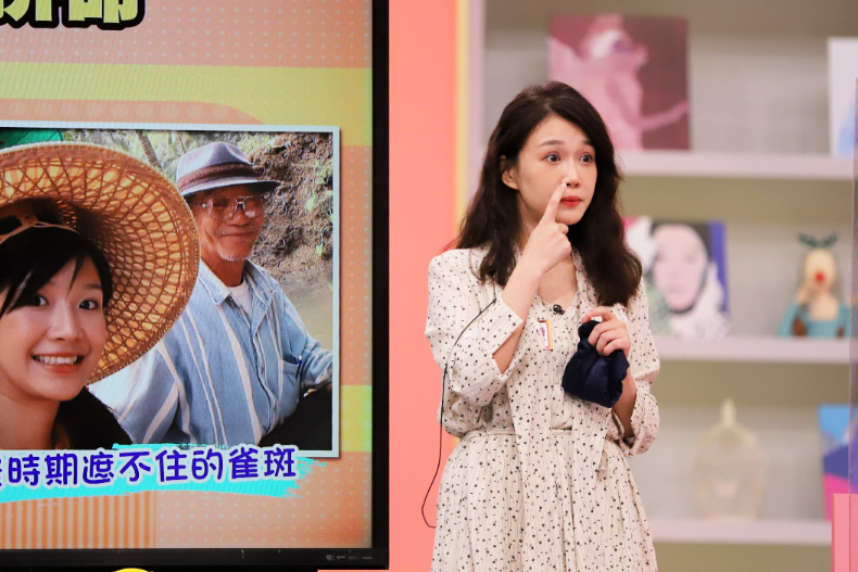 ▲李佳豫曾經有遮都遮不住地斑