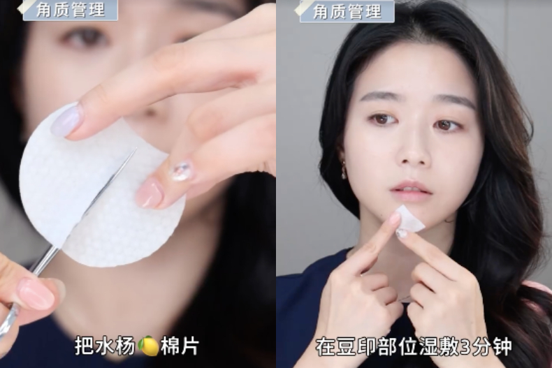 ▲角質管理