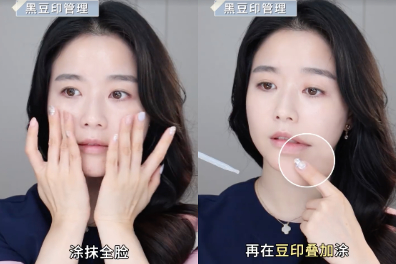 ▲黑痘印管理