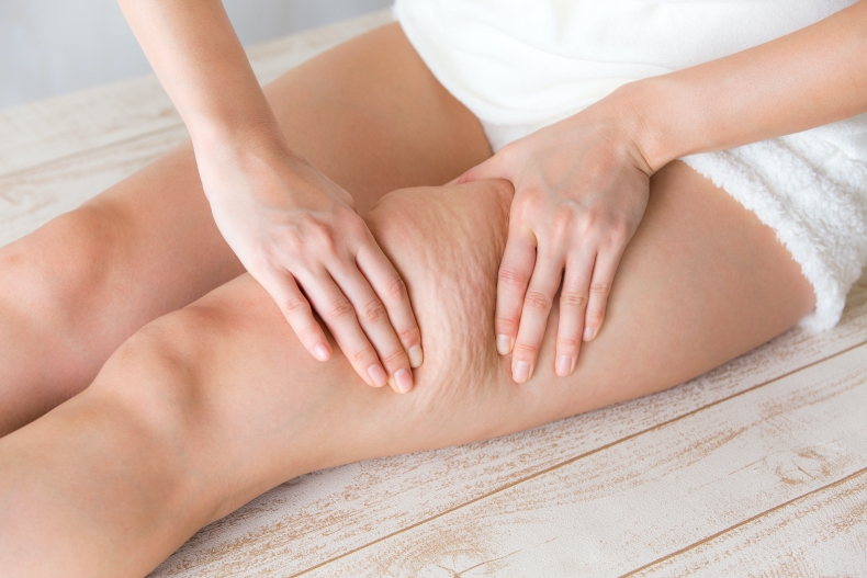 橘皮紋路如何消除？「2大壞習慣」是橘皮生成元兇，日常改善訣竅這邊看！