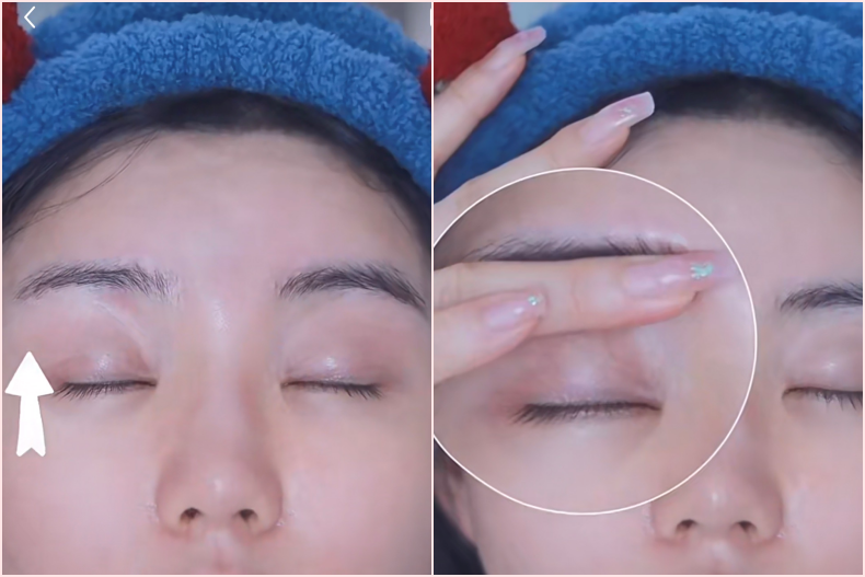 5步淡化黑眼圈按摩法！抗老眼霜不白塗，有效去除眼周細紋、暗沈