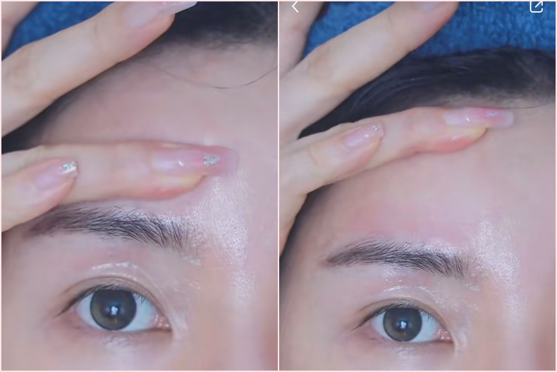 5步淡化黑眼圈按摩法！抗老眼霜不白塗，有效去除眼周細紋、暗沈