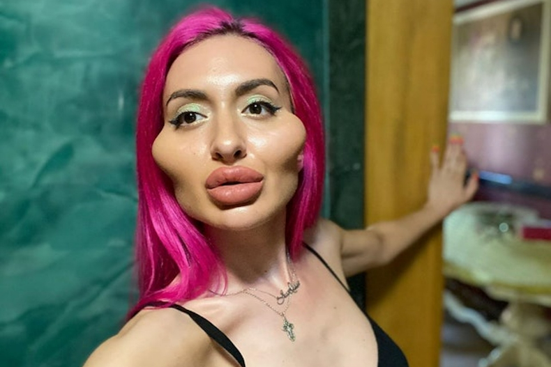 外國女瘋狂整容成「世界最大的臉頰」！自嘲是「最漂亮的怪物」：我就喜歡這樣的五官