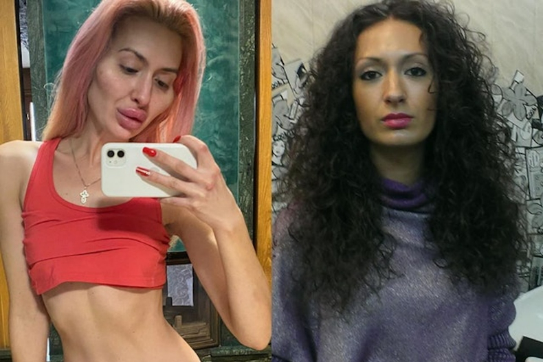 外國女瘋狂整容成「世界最大的臉頰」！自嘲是「最漂亮的怪物」：我就喜歡這樣的五官