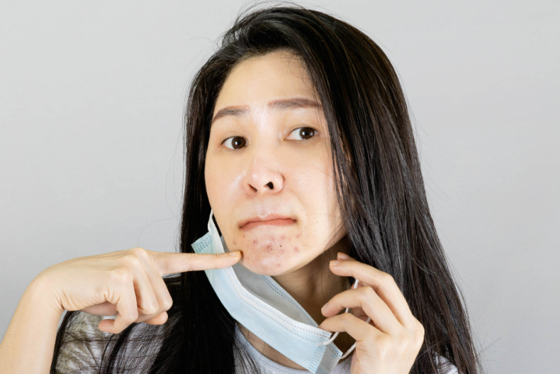 痘痘生長位置反映身體問題！中醫師分析「4部位」痘痘成因，肝肺腎心都有關
