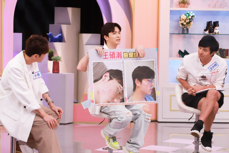 ▲王碩瀚分享臉爛時期有容貌焦慮