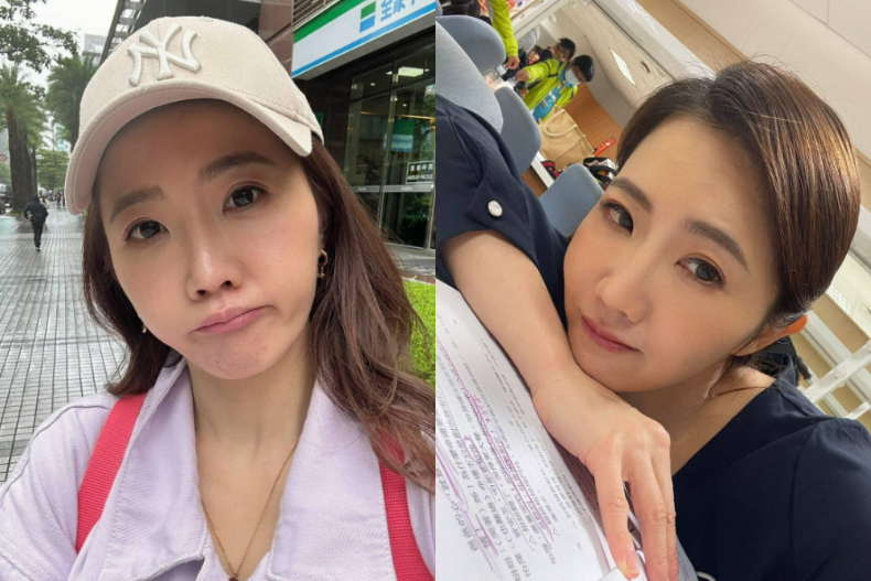 FotoJet - FotoJet.jpg 謝忻認:整形失敗!為改善顯老淚溝做了「這件事」,腫成麵龜差點毀容