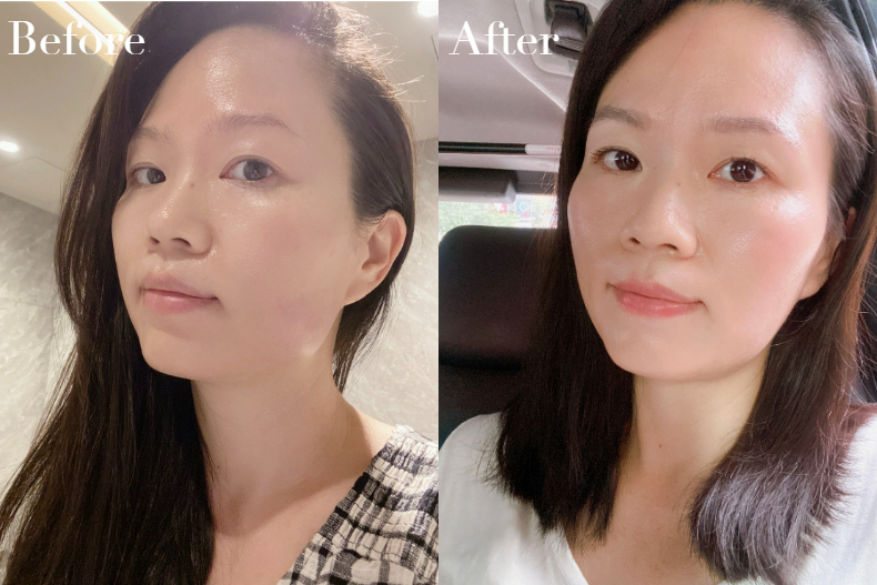 音波電波怎麼選？第一次打美國音波是什麼感覺？黃幼鳴醫師x小編經驗分享老實說