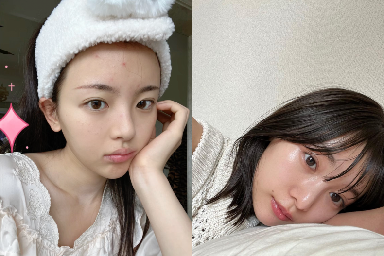 一喝牛奶就長痘？8個「不停長痘原因」大揭秘，太常洗臉、牙膏居然都是罪魁禍首！