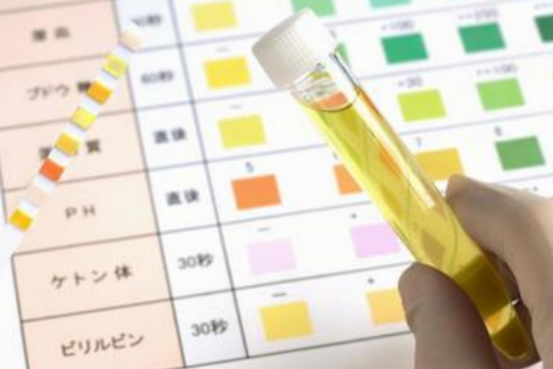 4種「尿液異常」症狀要警覺！頻尿竟有可能是「這疾病」的徵兆