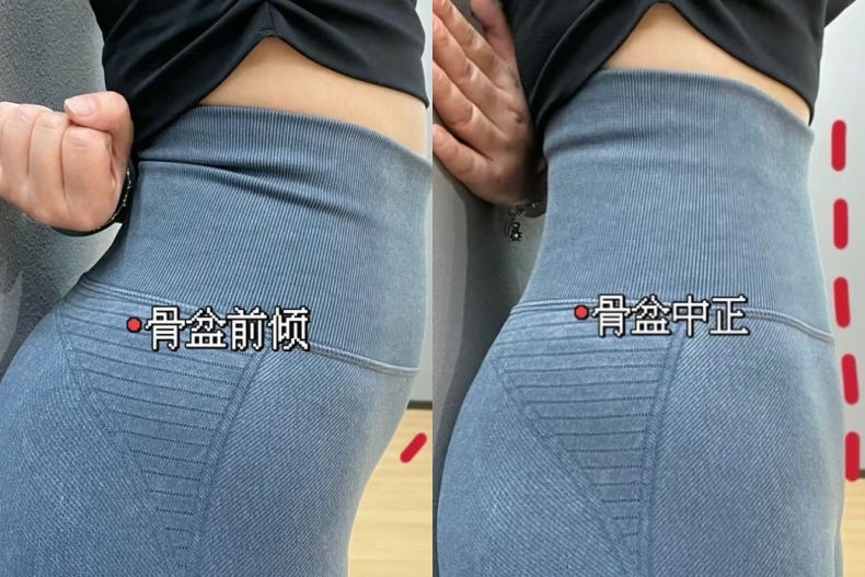 骨盆前傾症狀&自我測驗